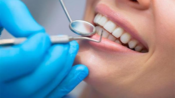 Фотография к новости: Тісті қалай тегін емдетуге болады?