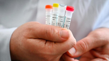 Фотография к новости: Министр «Омикрон» штамының елімізде таралу ықтималдылығы туралы айтты