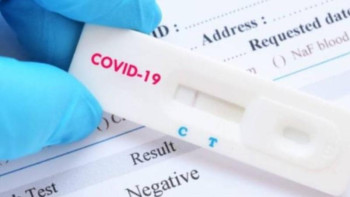 Фотография к новости: Алматыда COVID-19-ды анықтайтын жедел тестілер кеңінен таралуда