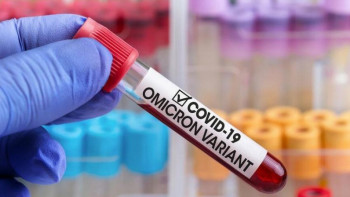 Фотография к новости: Елімізде «омикрон» штамын жұқтырғандар бар ма?