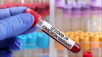 Фотография к новости: Омикрон. Штамның белгілері байқалса, не істеу керек?