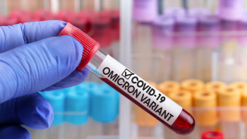 Фотография к новости: Омикрон. Елордада тәулігіне 1500-ге жуық адам вирус жұқтырып жатыр