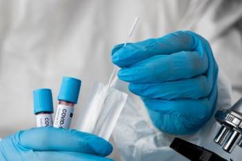 Фотография к новости: КВИ-дің келесі толқыны наурызда шегіне жетеді – Қарлығаш Әбдіжаббарова