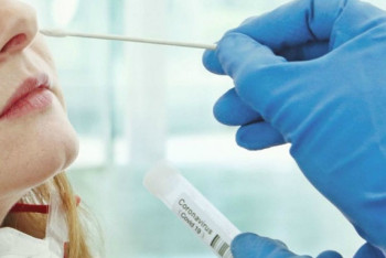 Фотография к новости: Студенттерден ПТР тестілеуді талап етуге жол берілмейді – БҒМ