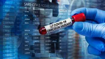 Фотография к новости: «Омикрон» штамы еліміздің  эпидемиологиялық жағдайын ушықтырды – министр 