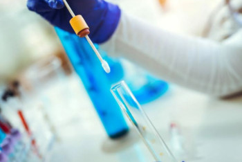 Фотография к новости: Ұсталғандар ПТР-сынамасының теріс нәтижесімен қабылданады - ІІМ