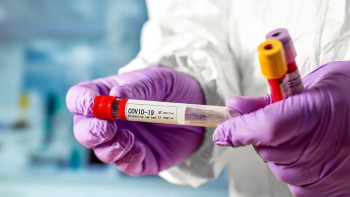 Фотография к новости: Коронавирус. Тәртіпсіздіктер індеттің өршуіне қалай әсер етті?