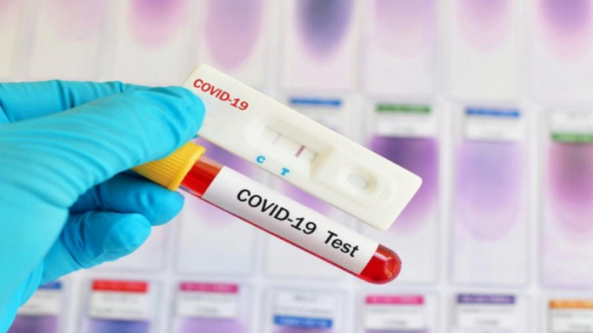 Экспресс тест коронавирусты нақты анықтай ала ма?