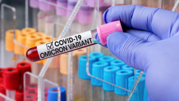 Фотография к новости: Омикрон. Астанада жаңа штамм жұқтырғандар саны артқан