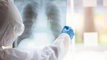 Фотография к новости: Коронавирус. Астанада 75 адам жансақтау бөлімінде жатыр