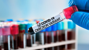 Фотография к новости: Омикрон VS Дельта. Штамдарды жұқтыру әлі азаймай тұр