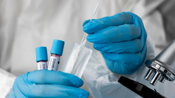 Фотография к новости: COVID-19. Қазақстан сырқаттанушылық бойынша әлем елдері арасында 120-орында тұр