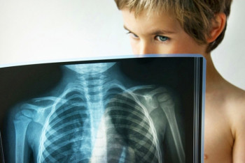 Фотография к новости: Былтыр 20-ға жуық астаналық жасөспірім туберкулез жұқтырды – СЭС өкілі