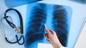 Фотография к новости: Елордада туберкулезге шалдыққандар саны артқан