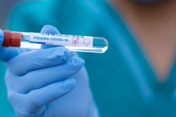 Фотография к новости: Коронавирус. Індетке шалдыққан науқастар саны азайып келеді