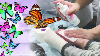 Фотография к новости: Сирек ауруға шалдыққан балалар үздіксіз күтімді қажет етеді