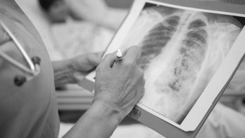 Фотография к новости: Коронавирус жүкті әйелдердің өлімін көбейтті – министр