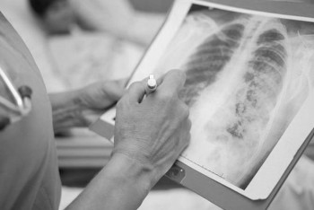 Фотография к новости: Коронавирус жүкті әйелдердің өлімін көбейтті – министр