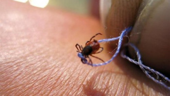 Фотография к новости: Кене шаққанда не істеу керек?