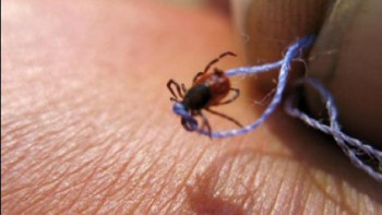 Фотография к новости: Бір айдың ішінде елордада 13 адамды кене шағып алған