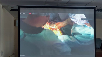 Фотография к новости: Елордада онкологиялық дертке шалдыққандарға 5 бірегей ота жасалды