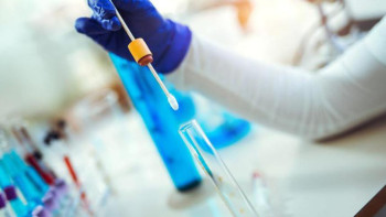 Фотография к новости: Коронавирус тағы көбейіп келе жатқан сыңайлы. Министрлік не дейді?