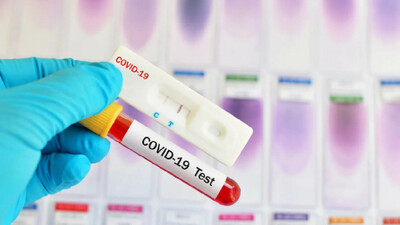 COVID-19. Індет жұқтырған 5 адамның жағдайы ауыр