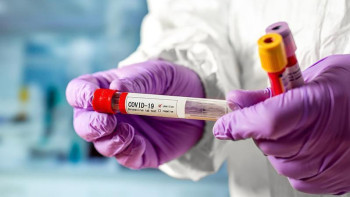 Фотография к новости: Коронавирус. Алматыда 2 392 науқас дәрігерлердің бақылауында