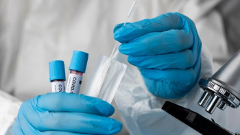 Фотография к новости: Коронавируспен күреске бөлінген 100 млрд теңге қайда жұмсалады?