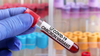 Фотография к новости: Омикрон штамын  30 жасқа дейінгі адамдар көп жұқтырады - Сархат Бейсенова