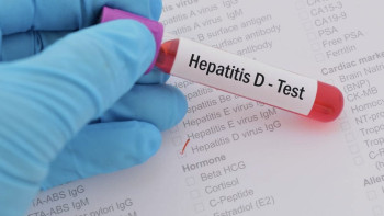 Фотография к новости: Елімізде 50 мыңға жуық адам вирус гепатитіне шалдыққан – бас гепатолог