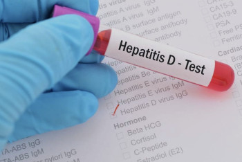 Фотография к новости: Елімізде 50 мыңға жуық адам вирус гепатитіне шалдыққан – бас гепатолог