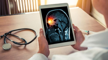 Фотография к новости: Дәрігер: Балалар арасында ми мен жұлын ісіктері өршіп тұр