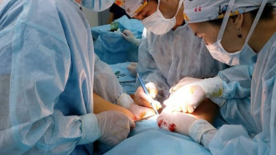 Алматылық дәрігерлер балаларға күрделі микрохирургиялық операция жасады