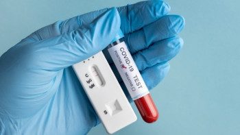 Фотография к новости: ДСМ: Елде тәулігіне 120 адам коронавирус жұқтырады