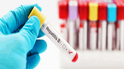 Биыл А вирустық гепатиті көбеюі мүмкін – эпидемиолог болжамы