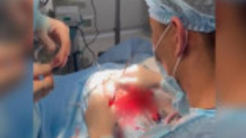 Фотография к новости: "Басы жиі ауыратын". Шымкентте 10 жастағы баланың миынан 15 құрт алынды