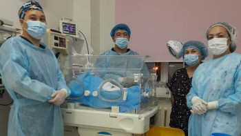 Фотография к новости: Дәрігерлер асқазан-ішек ақауымен дүниеге келген сәбиді аман алып қалды