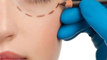 Фотография к новости: Өскеменде блефаропластика жасатуға барған әйел бақиға кетті