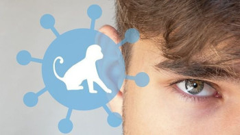 Фотография к новости: ДДҰ: маймыл шешегіне байланысты жарияланған ТЖ режимі аяқталды