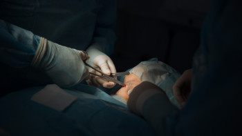 Фотография к новости: Алматылық онкологтар ер адамның бетіндегі үлкен ісікті алып тастады