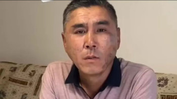 Фотография к новости: Адам танымастай күйге түскен Арман Қайназаров күтпеген мәлімдеме жасады