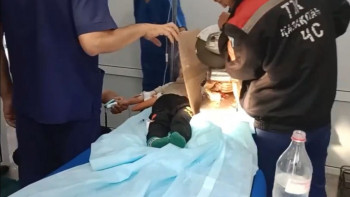 Фотография к новости: Шымкентте баланың қолы ет тартқышқа қысылып қалған