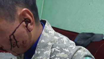 Фотография к новости: «Іле Алатауы» ұлттық паркінің орманшысын естен танғанша ұрып кеткен