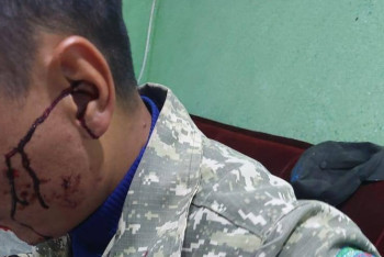 Фотография к новости: «Іле Алатауы» ұлттық паркінің орманшысын естен танғанша ұрып кеткен