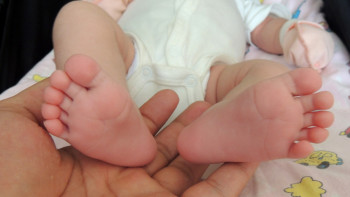 Фотография к новости: Өткен жылы қанша егіз бен үшем дүниеге келді