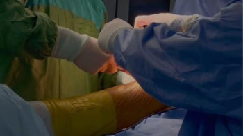 Фотография к новости: Күрделі диагнозы бар пациентке жасанды жамбас салынды