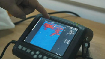 Фотография к новости: Ғалымдар 956 миллион теңге ұтып алды