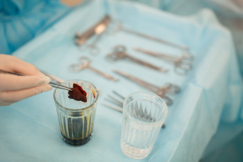 Елордалық дәрігерлер елімізде алғаш рет өте сирек кездесетін дертке ота жасады