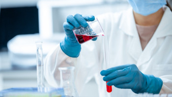 Фотография к новости: Алматыда қызылша жұқтырғандардың 60%-ы балалар